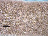 3 - Cellule corticali in visione superficiale